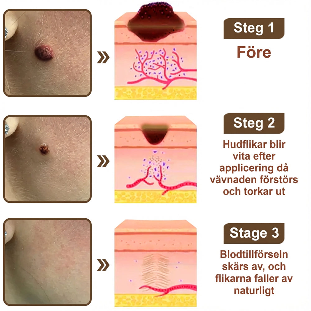 Black Rice Skin Repair Essence Cream ⚕️ FDA-certifierad (tar bort vårtor och hudutväxter, förbättrar keratinuppbyggnad och seborroiskt eksem, follikulär keratos, åldersfläckar och blåmärken)