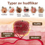 Black Rice Skin Repair Essence Cream ⚕️ FDA-certifierad (tar bort vårtor och hudutväxter, förbättrar keratinuppbyggnad och seborroiskt eksem, follikulär keratos, åldersfläckar och blåmärken)