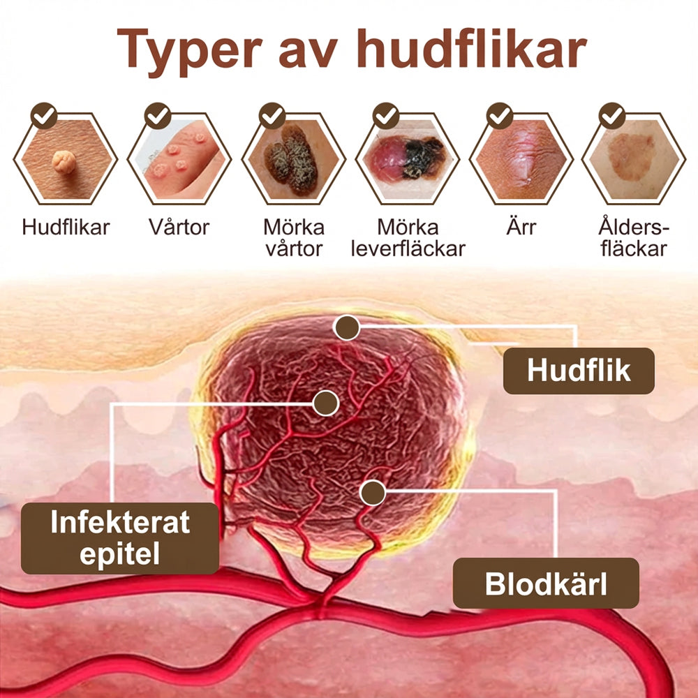 Black Rice Skin Repair Essence Cream ⚕️ FDA-certifierad (tar bort vårtor och hudutväxter, förbättrar keratinuppbyggnad och seborroiskt eksem, follikulär keratos, åldersfläckar och blåmärken)